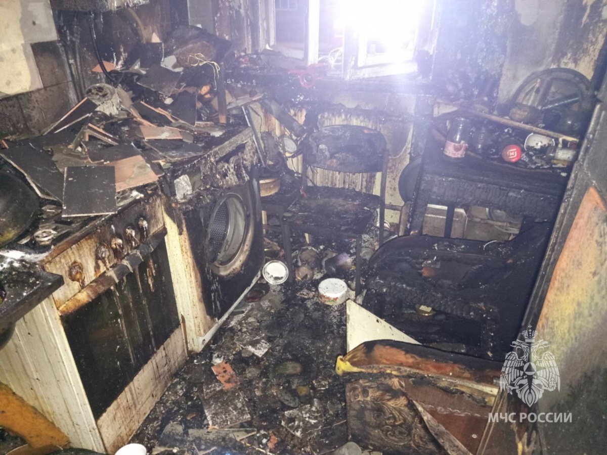 Один человек получил ожоги на пожаре в многоквартирном доме на Бору - фото 1