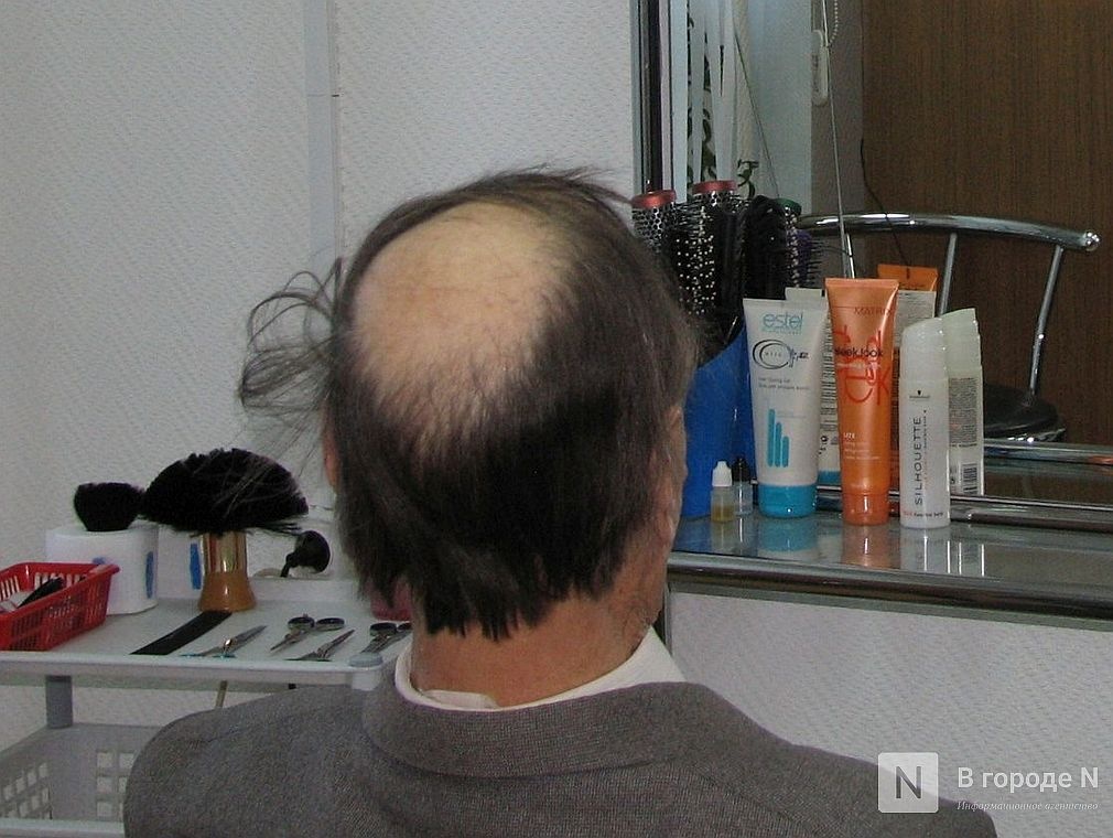 Нижегородские ученые объяснили выпадение волос у переболевших COVID-19 