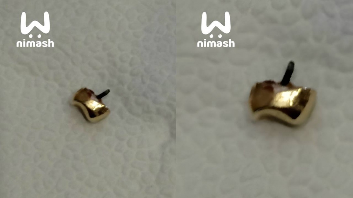 Золотой зуб в роллах обнаружили посетители дзержинского суши-бара - фото 1